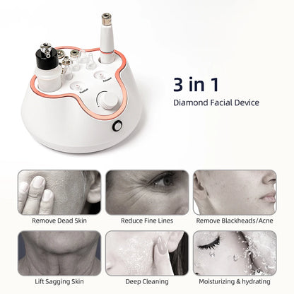 Professional Diamond Microdermabrasion Machine – At-Home Facial Peeling & Deep Cleaning Skin Care Tool