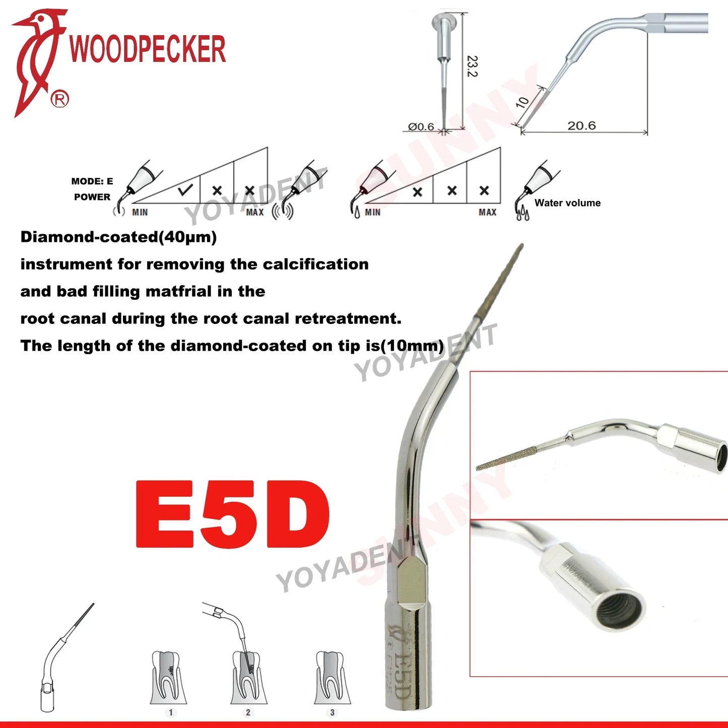 Woodpecker Dental Scaler Tips – Ultrasonic Tooth Cleaning, Endo & Perio Scaling Tips, Fit EMS UDS Scaler Handpiece