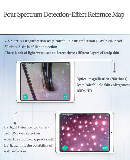 WiFi HD 5G Scalp, Skin & Hair Follicle Detector – 50X/200X Rechargeable UV Skin Analyzer Magnifier