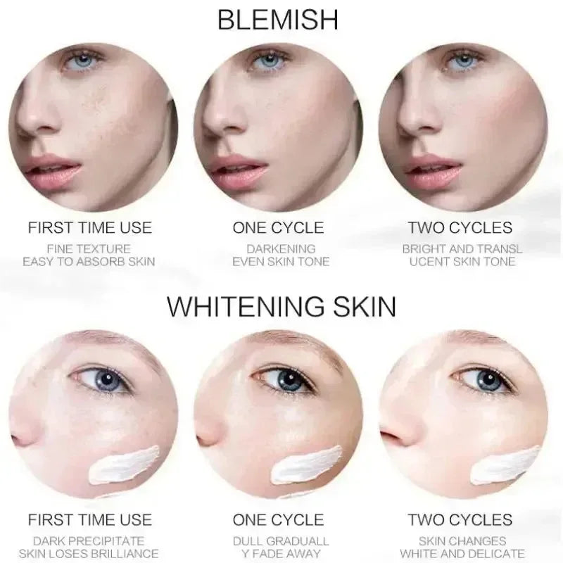 Niacinamide Whitening Freckle Cream – Anti Dark Spot, Melasma & Pigmentation Removal Anti-Aging Skin Brightening Cream (1/3/5pcs)