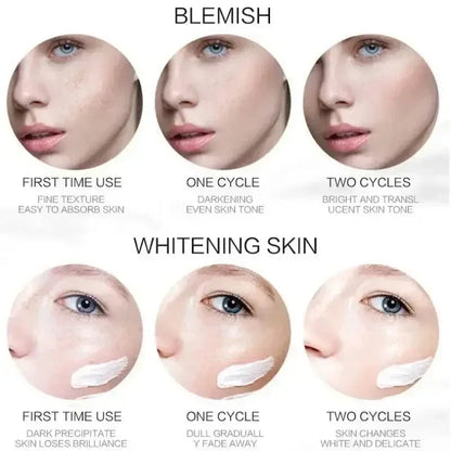 Niacinamide Whitening Freckle Cream – Anti Dark Spot, Melasma & Pigmentation Removal Anti-Aging Skin Brightening Cream (1/3/5pcs)