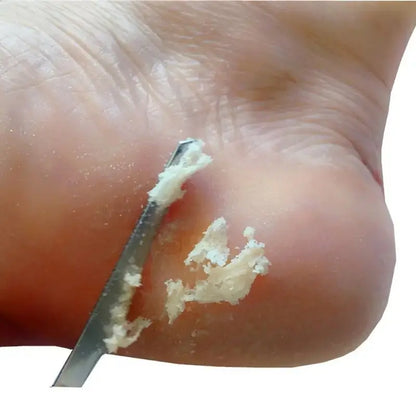 Stainless Steel Foot Knife - Dead Skin Remover, Callus Rasp & Toe Nail Shaver for Pedicure & Foot Care in Shops