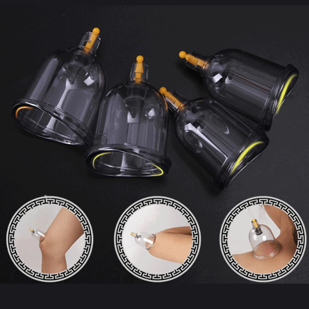 12/24-Cup Chinese Vacuum Cupping Therapy Set – Pull-Out Suction Massager for Pain Relief & Muscle Relaxation