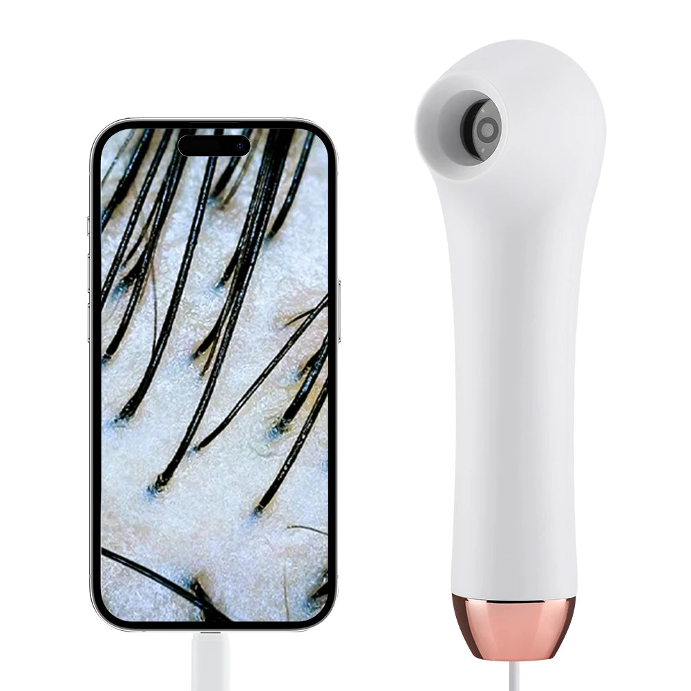 Multifunctional HD Scalp & Skin Analyzer — Hair Follicle Detector with Magnifier for Phone & Tablet