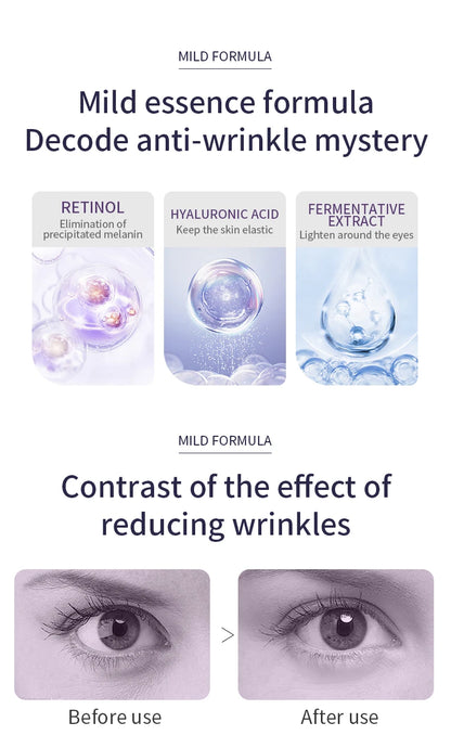 O'CHEAL Anti-Wrinkle Eye Cream Roller – Dark Circle & Puffiness Reducer with Hyaluronic Acid for Anti-Aging Skin Care