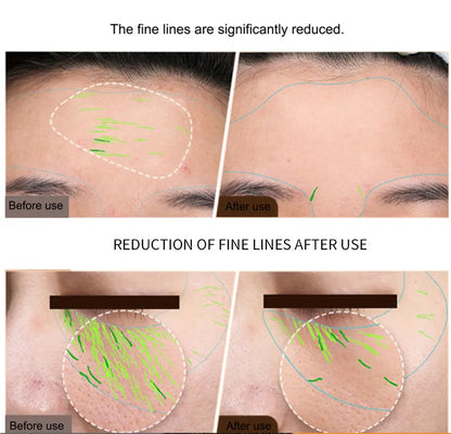 EMS Facial & Body RF Machine – Professional Radio Frequency Beauty Device for Skin Tightening, Face Lifting, and Anti-Aging