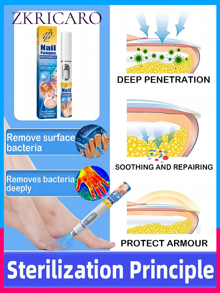 2025 Nail Cleaning Tools – 2nd Gen Blue Light Laser for Root Repair & Nail Care