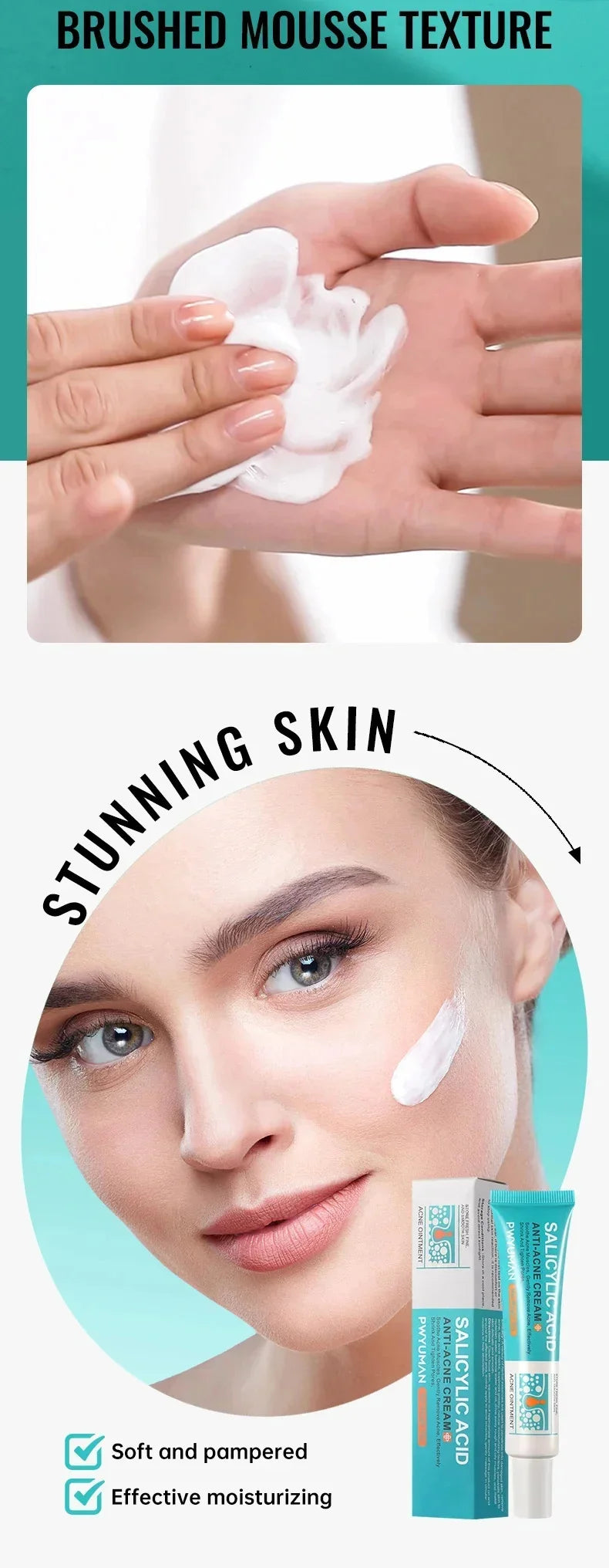 Salicylic Acid Acne Removal Cream – Anti-Acne, Redness Repair, Deep Cleaning & Oil Control Skincare