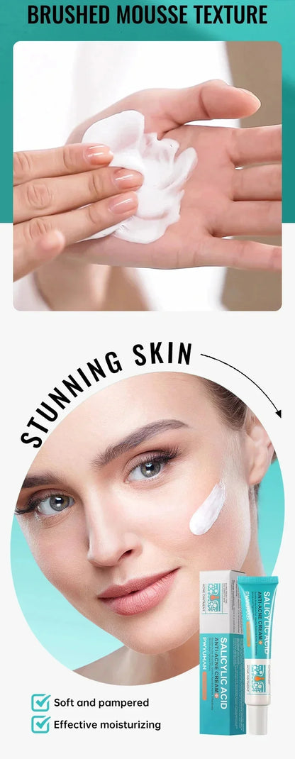 Salicylic Acid Acne Removal Cream – Anti-Acne, Redness Repair, Deep Cleaning & Oil Control Skincare