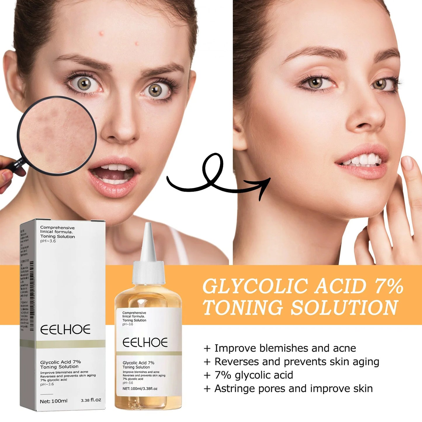 100ML Glycolic Acid Toner – Ordinary Acne Remover, Lifting & Firming, Wrinkle Reduction, Glowing Facial Skincare Gift