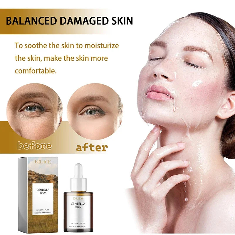 Centella Asiatica Face Serum – Nourishing, Brightening & Moisturizing Cream for Dry Skin Rejuvenation