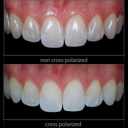 Godox MF12 Dental Photography Polarizer Kit Cross-Polarization Flash Set for Reflection-Free Intraoral & Clinical Imaging