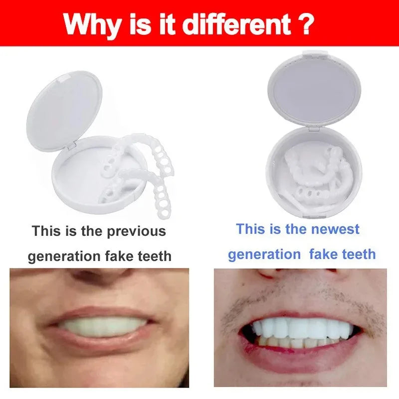 Teeth Veneers & Whitening Denture Kit – Temporary False Teeth Cover for Comfortable, Perfect Smile
