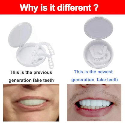 Teeth Veneers & Whitening Denture Kit – Temporary False Teeth Cover for Comfortable, Perfect Smile