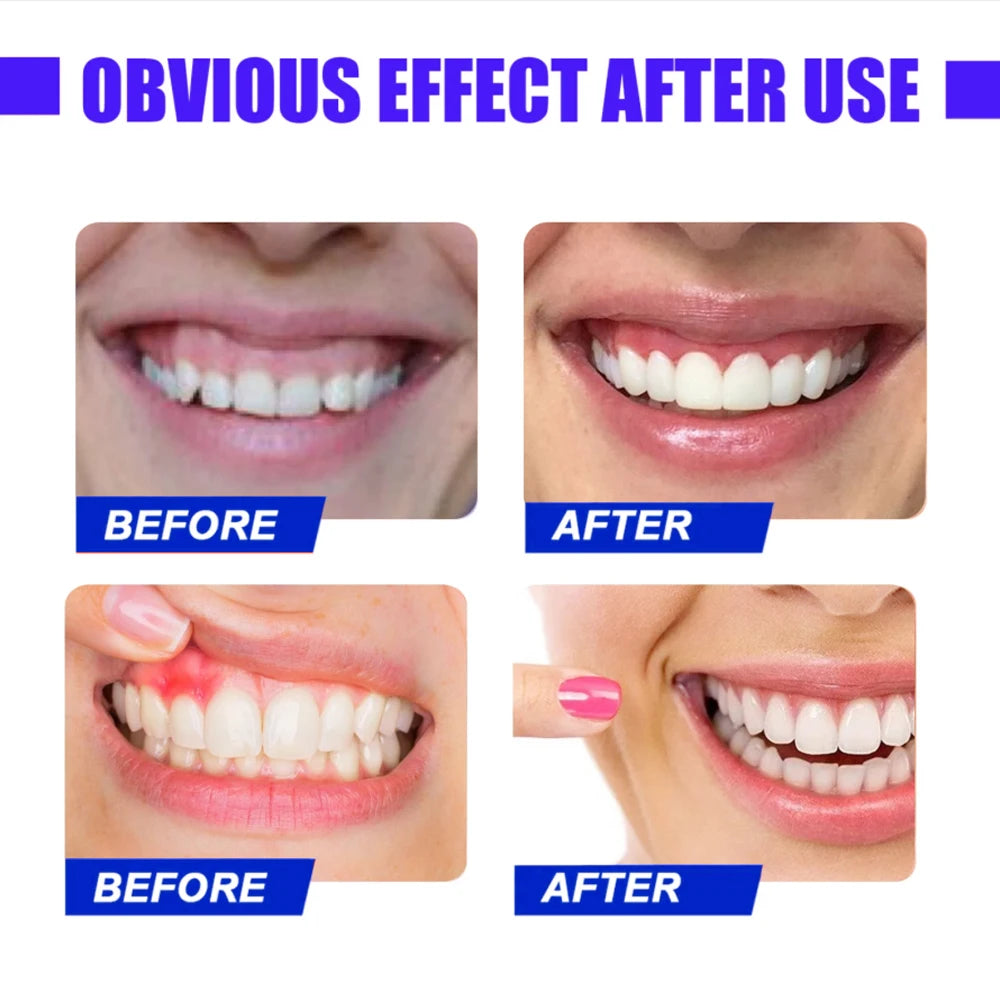 Red Light Therapy Device – Fast Relief for Tooth Pain & Gum Sensitivity