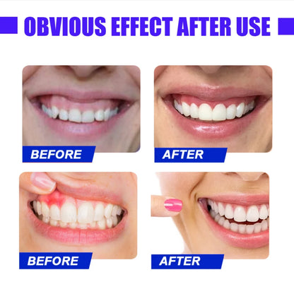 Red Light Therapy Device – Fast Relief for Tooth Pain & Gum Sensitivity