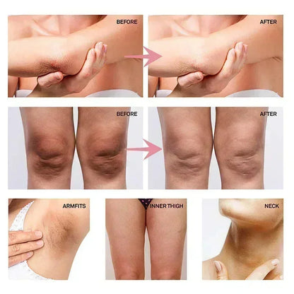 Brightening Body Serum Cream – Underarm, Knee & Inner Thigh Skin Care Moisturizer for Even Tone, Dark Spot Care & Smooth Skin Appearance