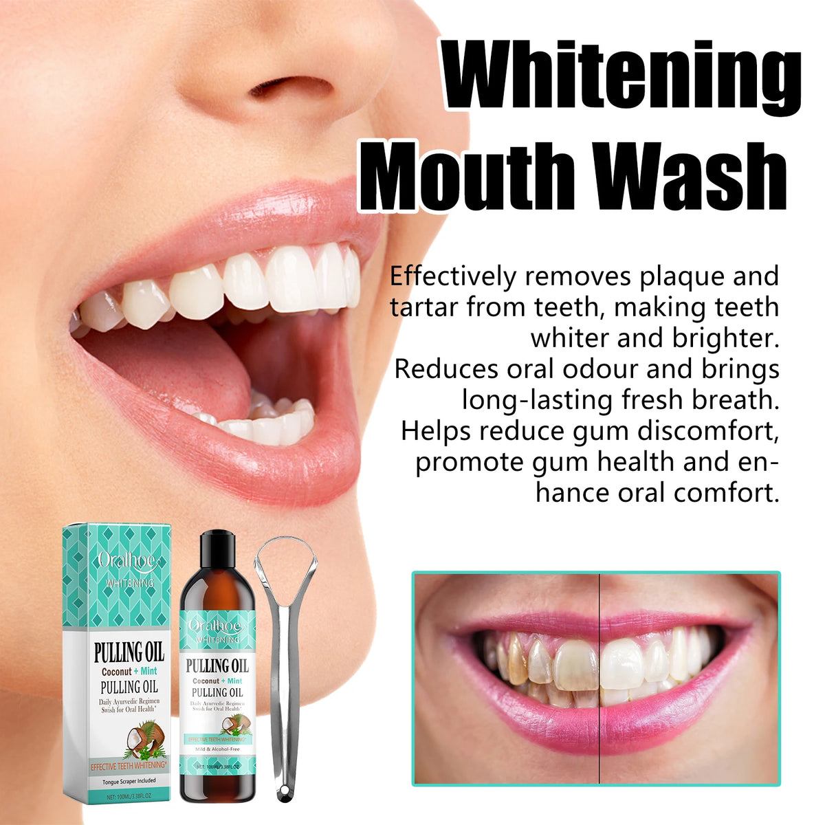 Coconut Mint Oil Pulling Mouthwash Kit - Fresh Breath Oral Care Set with Tongue Scraper for Daily Hygiene