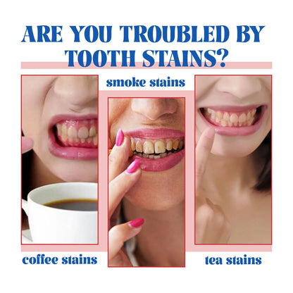 SP6 Probiotic Whitening Toothpaste – Stain Removal, Fresh Breath & Yellow Teeth Reduction for Daily Oral Care