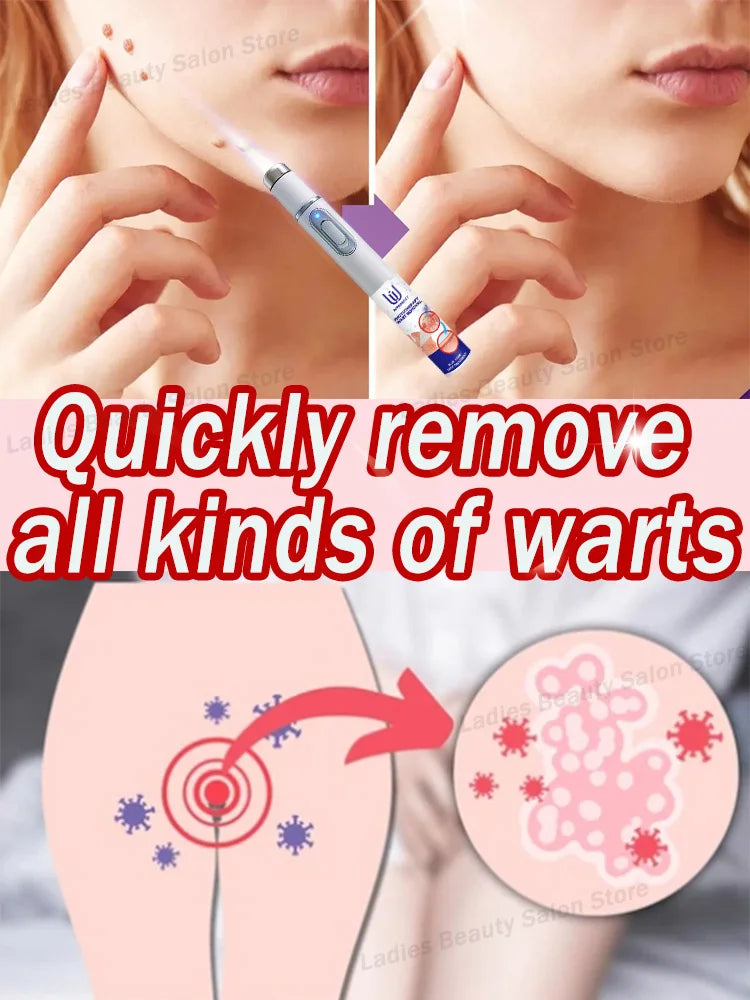 Quick Wart & Sarcoma Removal Treatment – Fast & Effective Skin Care Solution