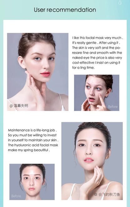 10pcs Hyaluronic Acid Hydrating Facial Mask – Moisturizing, Pore Shrinking Skin Care Face Masks