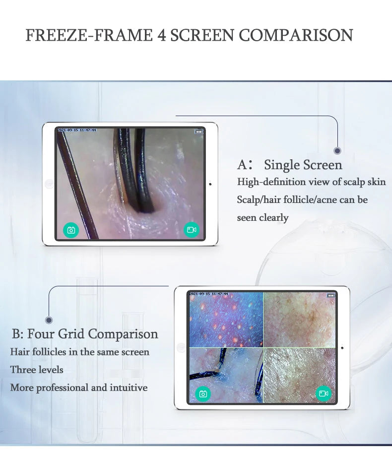 New WiFi HD 5G Scalp & Skin Hair Follicle Detector - Professional 50X/200X Rechargeable UV Skin Analyzer Magnifier