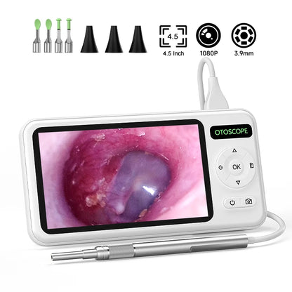 4.5-Inch HD Digital Otoscope - 1080P Ear Camera with 3.9mm Lens & 6 LEDs for Ear Wax Removal, Kids & Adults