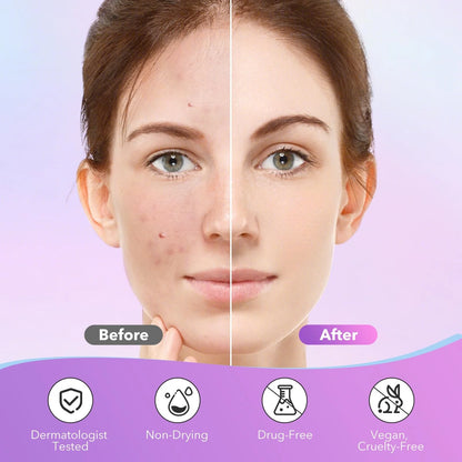 1680-Count Star-Shaped Pimple Patches - Multicolor Acne and Blemish Cover Stickers for Daily Facial Skincare