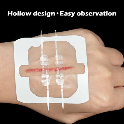 Camping Wound Closure Strips – Painless Adhesive Suture Patch for Fast Hemostatic Care & First Aid