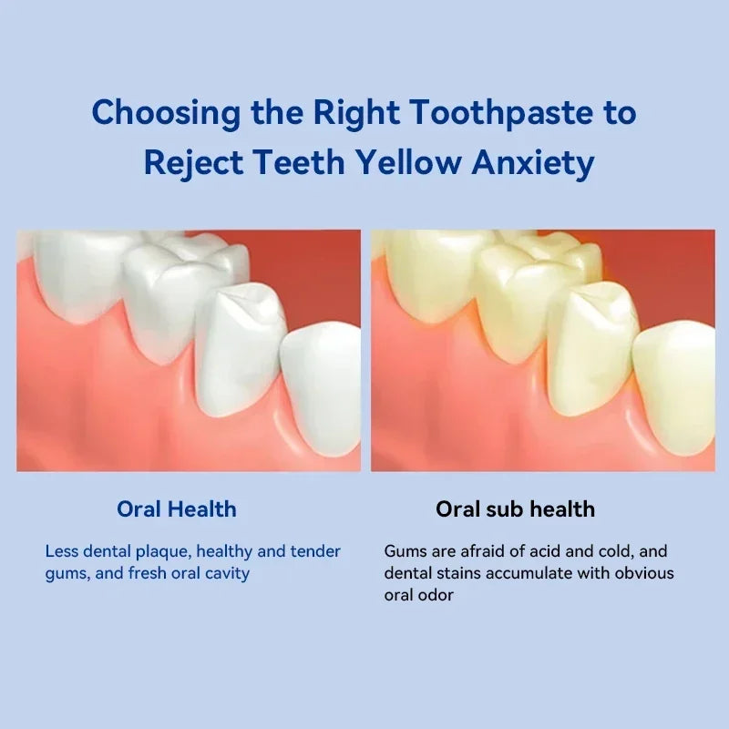 Dental Calculus Remover – Bad Breath & Whitening Teeth Care, Prevent Periodontitis & Brighten Smile