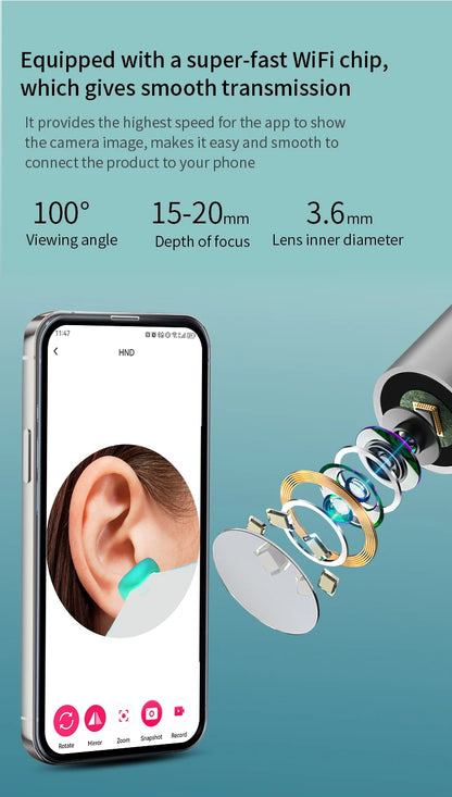 Smart Visual Ear Cleaner 1296P with Camera – USB-C Rechargeable Ear Wax Removal Tool, WiFi, 6 LED Lights