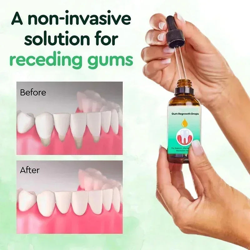 30ml Gingival Repair Drops – Fast Treatment for Cavities, Receding Gums & Gum Pain Relief