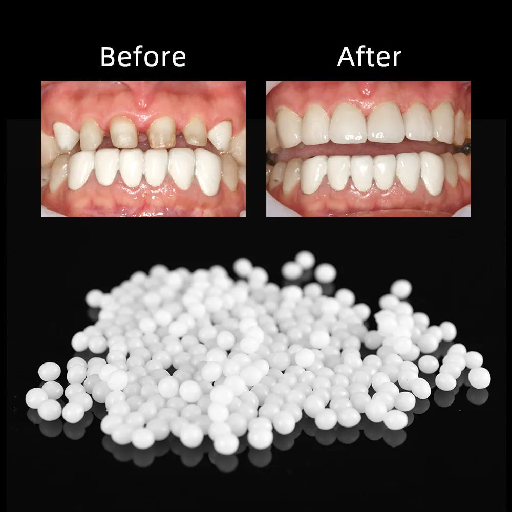 Temporary Tooth Repair Beads – Food Grade Dental Filling Material for Missing or Broken Teeth, False Teeth Glue, Denture Repair