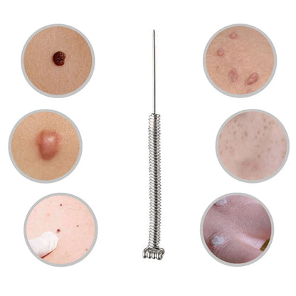 50/100pcs Sterile Surgical Needles for Mini Mole Removal Pen – Spot, Freckle & Plasma Point Beauty Accessories
